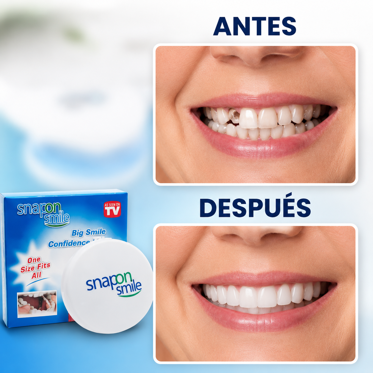 Carillas Dentales Moldeables - SnapOn™ 3x1
