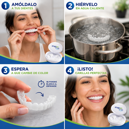 Carillas Dentales Moldeables - SnapOn™ 3x1